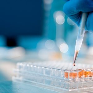 IVD Üreticilerine Güven Veren Belgelendirme Hizmeti: ISO 13485 Uzmanlığımızla Yanınızdayız!