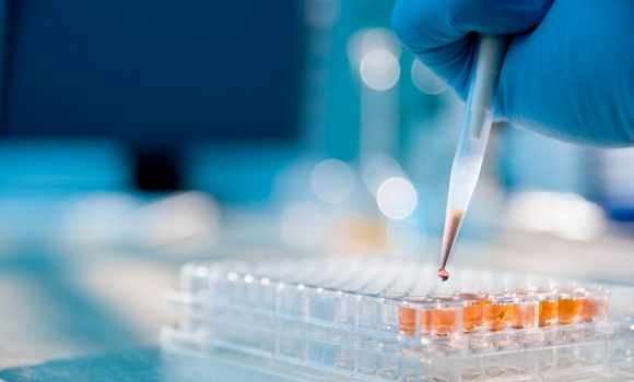 IVD Üreticilerine Güven Veren Belgelendirme Hizmeti: ISO 13485 Uzmanlığımızla Yanınızdayız!